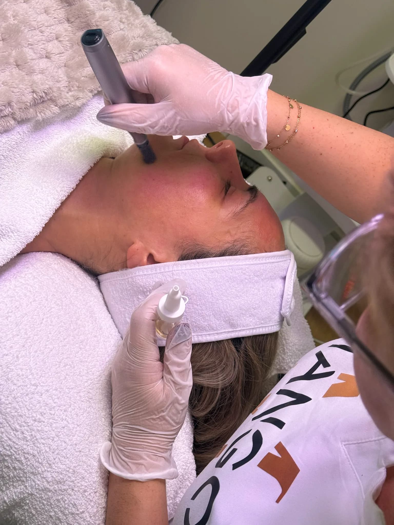 Microneedling in Frankfurt — Hauterneuerung mit Soforteffekt — Sahel Beauty Frankfurt (Bild 2)