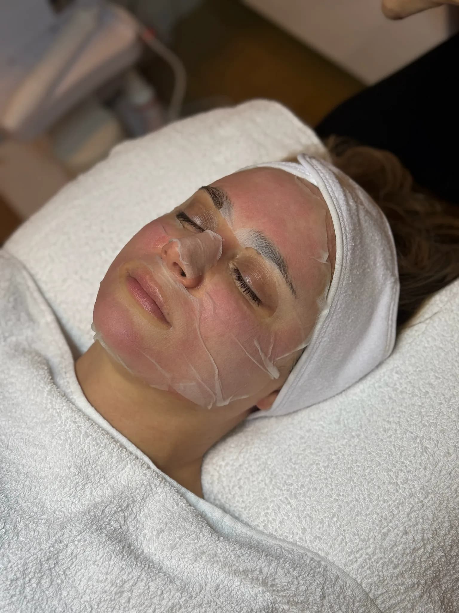 Microneedling in Frankfurt — Hauterneuerung mit Soforteffekt — Sahel Beauty Frankfurt (Bild 5)