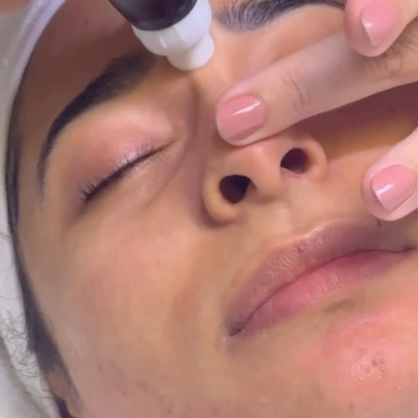 Aquafacial in Frankfurt — Tiefenreinigung mit Sofort-Glow — Sahel Beauty Frankfurt (Bild 5)