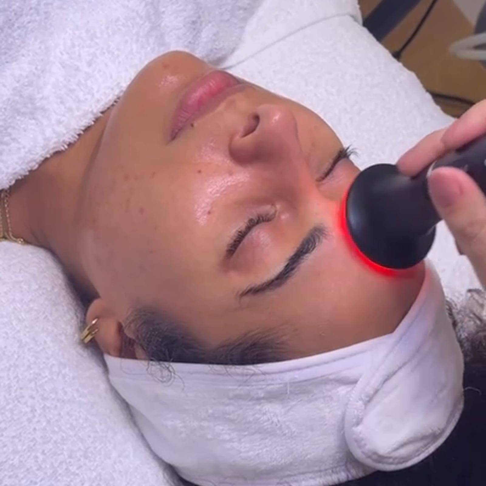 Aquafacial in Frankfurt — Tiefenreinigung mit Sofort-Glow — Sahel Beauty Frankfurt (Bild 6)