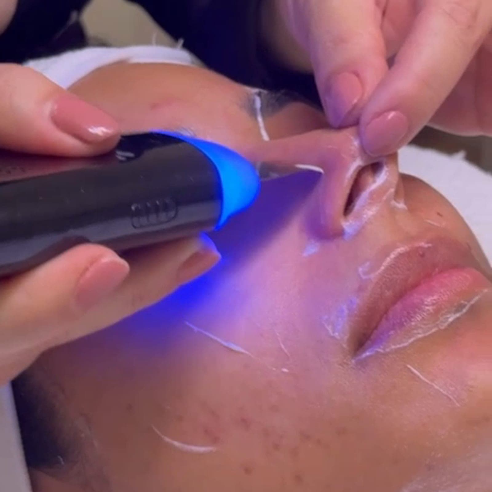 Aquafacial in Frankfurt — Tiefenreinigung mit Sofort-Glow — Sahel Beauty Frankfurt (Bild 9)