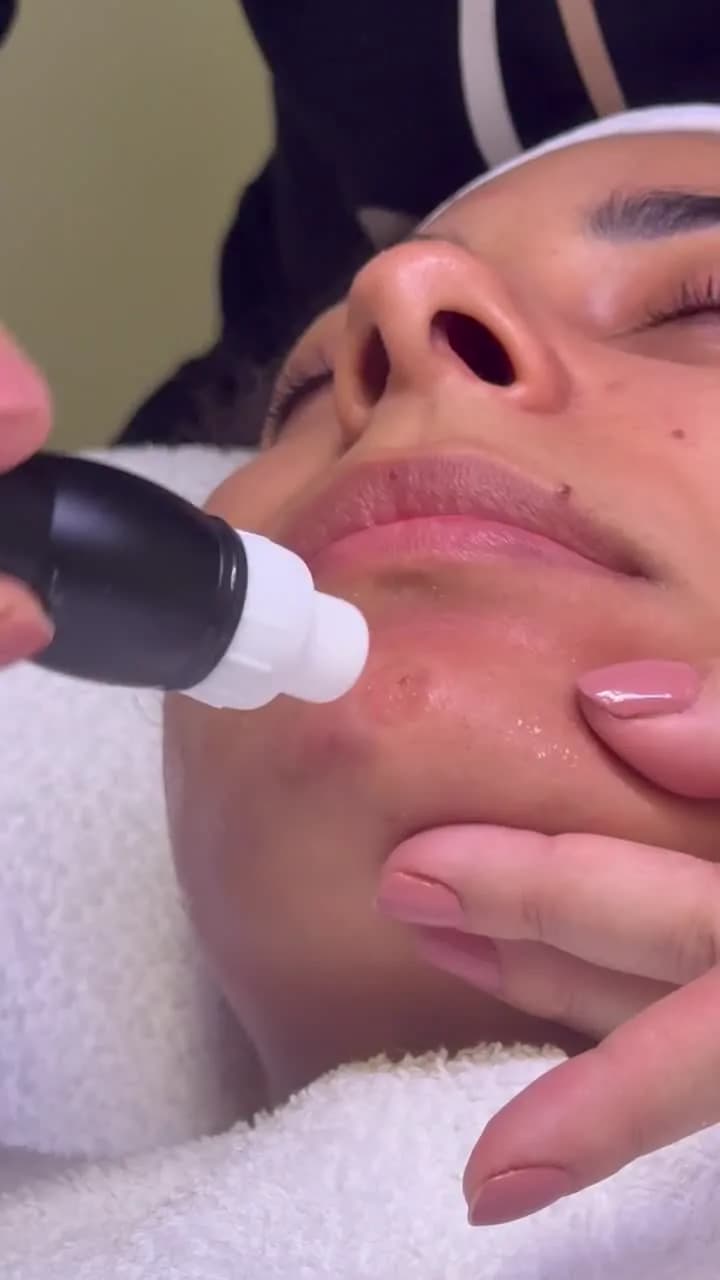 Aquafacial in Frankfurt — Tiefenreinigung mit Sofort-Glow — Sahel Beauty Frankfurt (Bild 15)