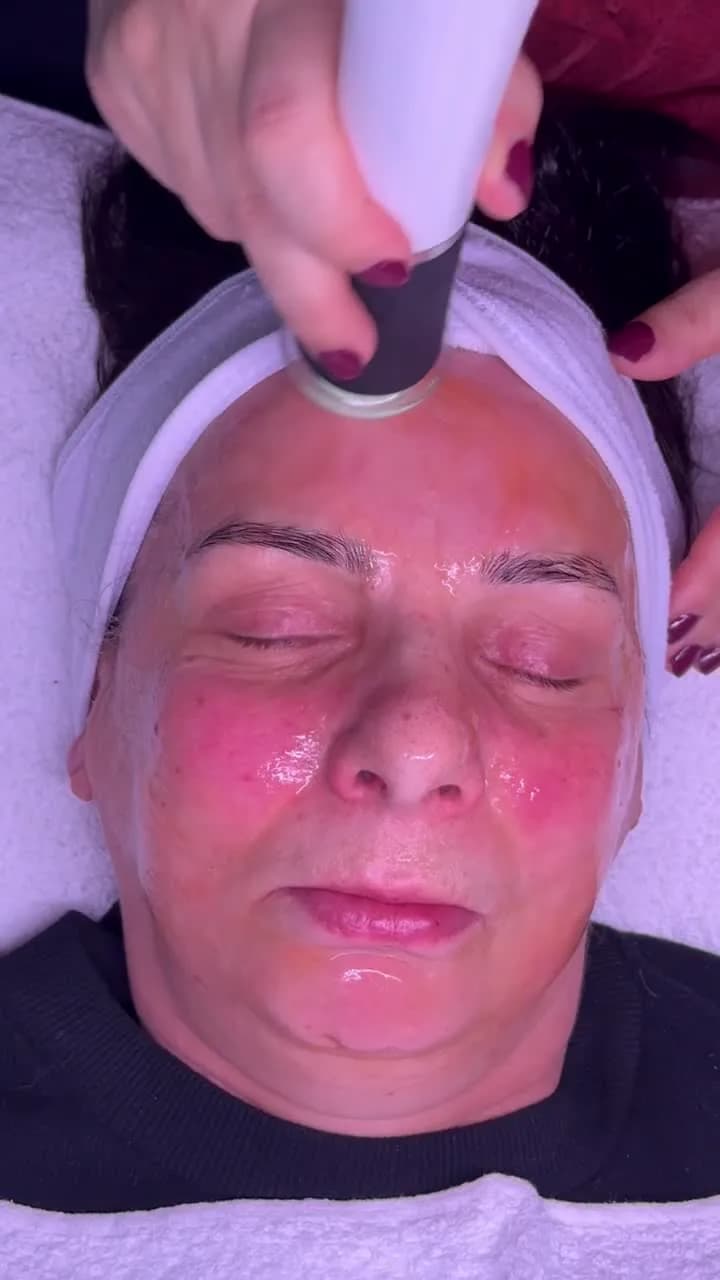 Pollogen Therapy – OxyGeneo — Sahel Beauty Frankfurt (image 1)