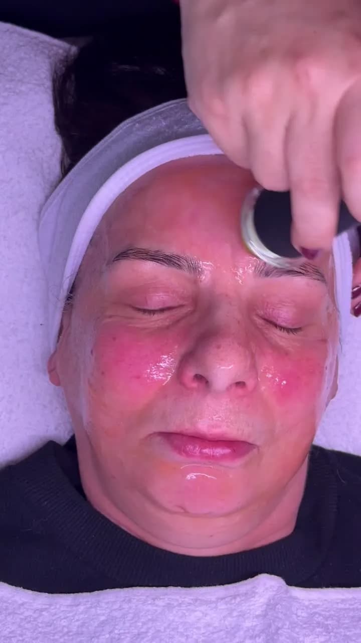 Pollogen Therapy – OxyGeneo — Sahel Beauty Frankfurt (image 2)