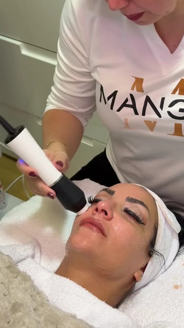 Radiofrequenz-Lifting in Frankfurt — straffere Haut ohne OP — Sahel Beauty Frankfurt (Bild 2)